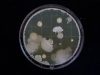Study Reveals Hidden Tumors May Be More Vulnerable to Immune Attack Study Reveals Hidden Tumors May Be More Vulnerable to Immune Attack